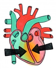 Ein Herzorgan ist zusehen. Es ist in grün und Blau gemalt. 2 Pfeile zeigen auf die Herzmittelwand.